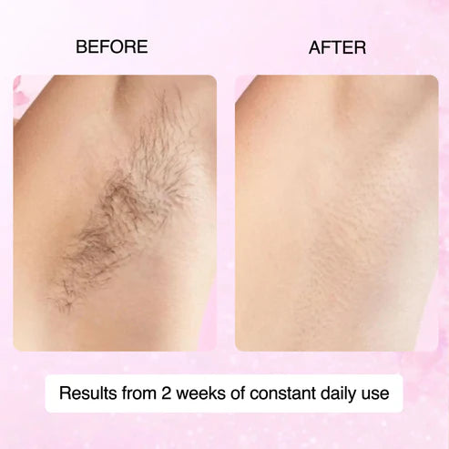 100% Natural Cyperus Rotundus Skin Serum